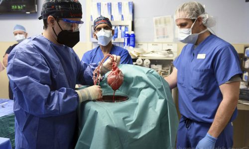 US surgeon ได้ทำการปลูกถ่ายหัวใจหมูให้ผู้ป่วยที่เป็นมนุษย์